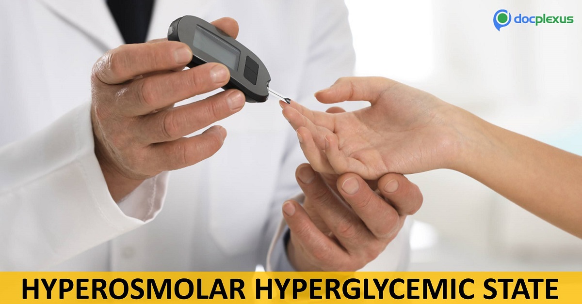 Diagnostic Indicators of Hyperosmolar Hyperglycemic State