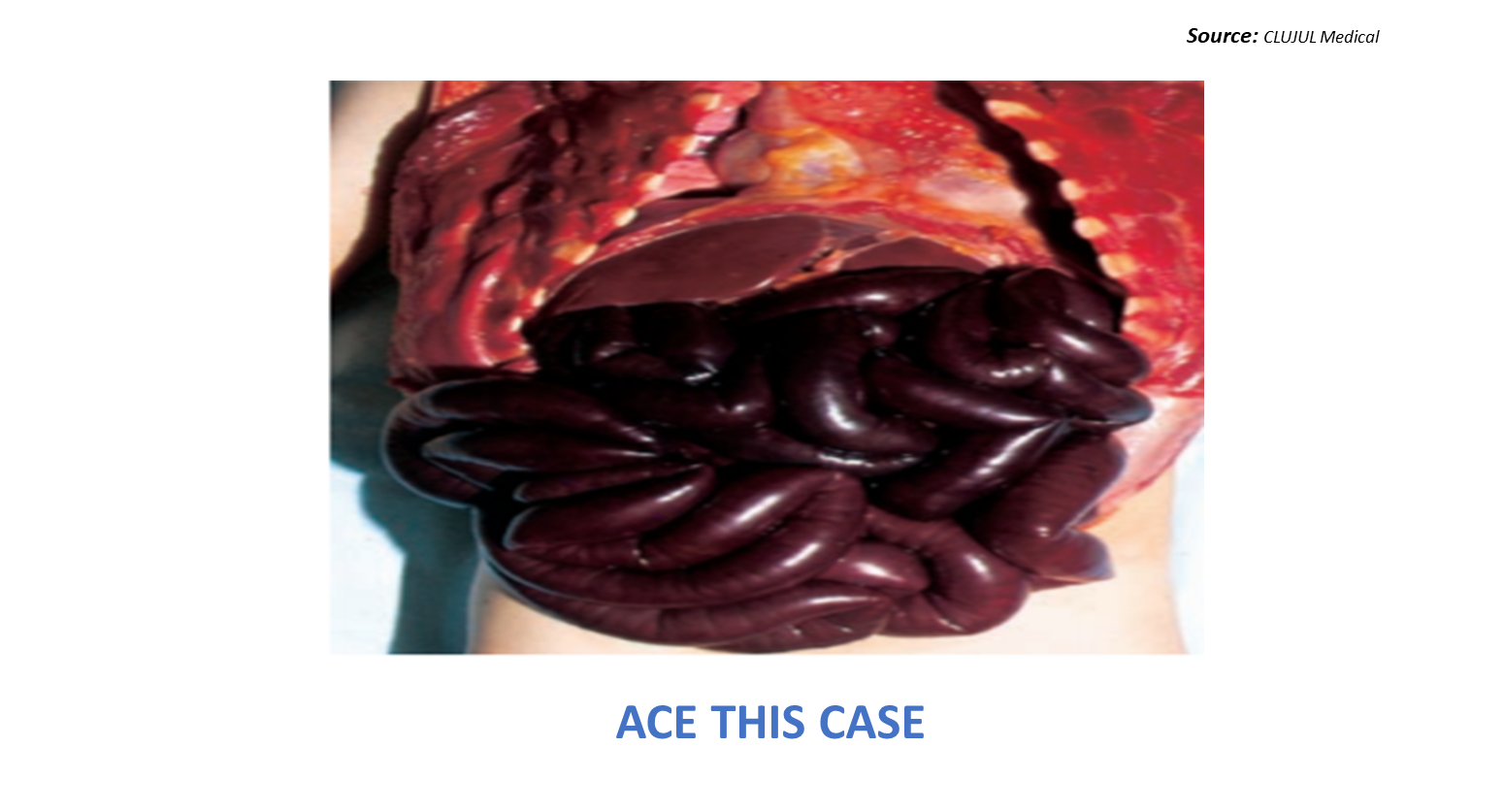 An Emergency Case of Abdominal Pain in an Infant