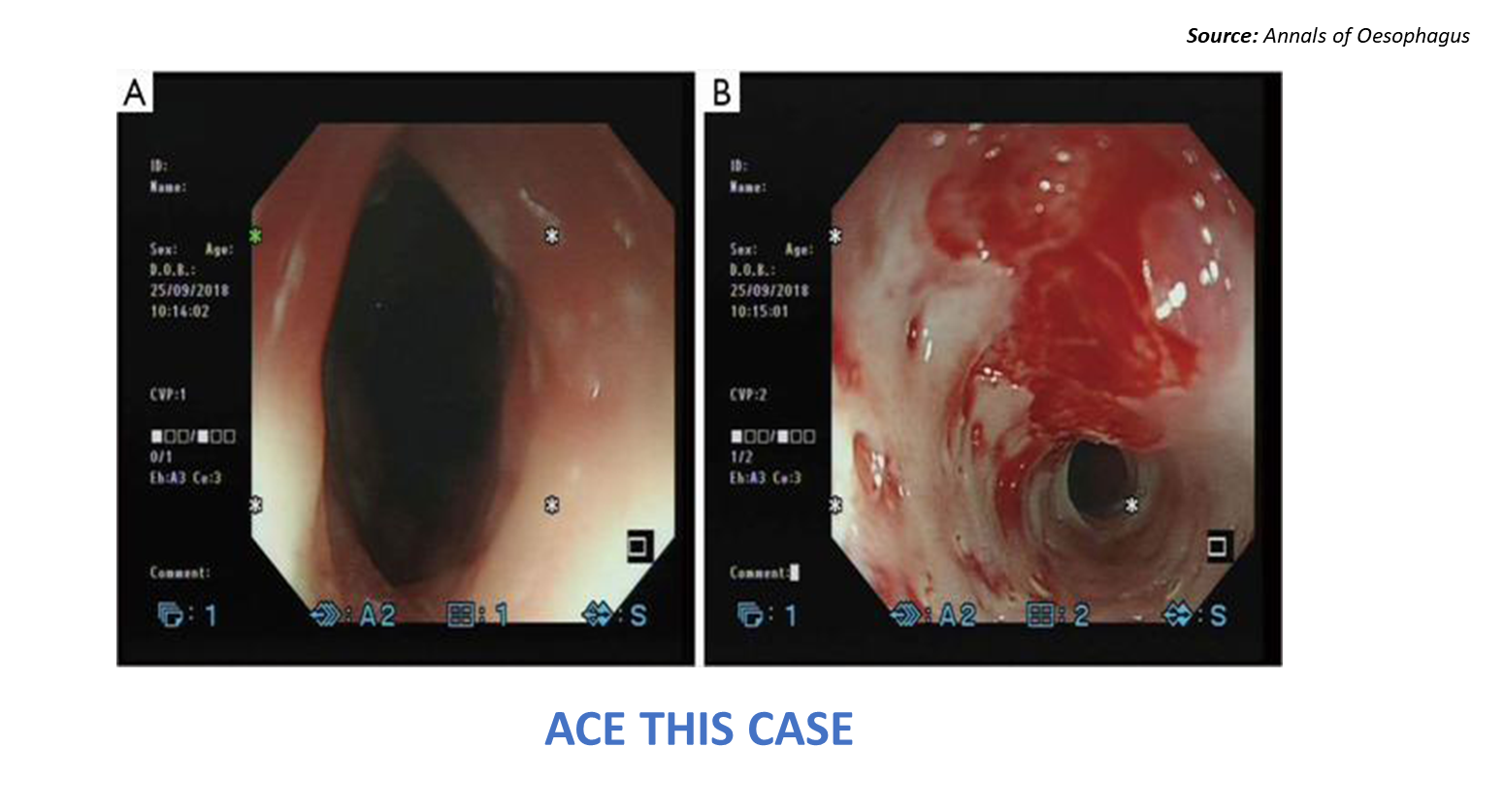 Can you help in the diagnosis of this patient's condition?