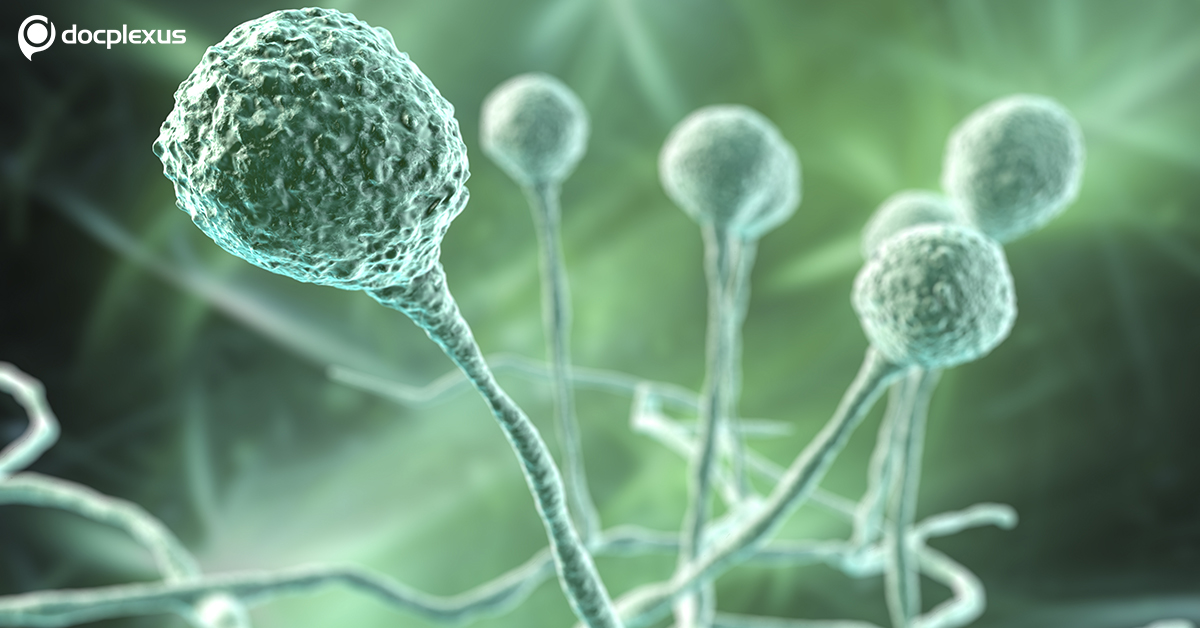 All About Mucormycosis