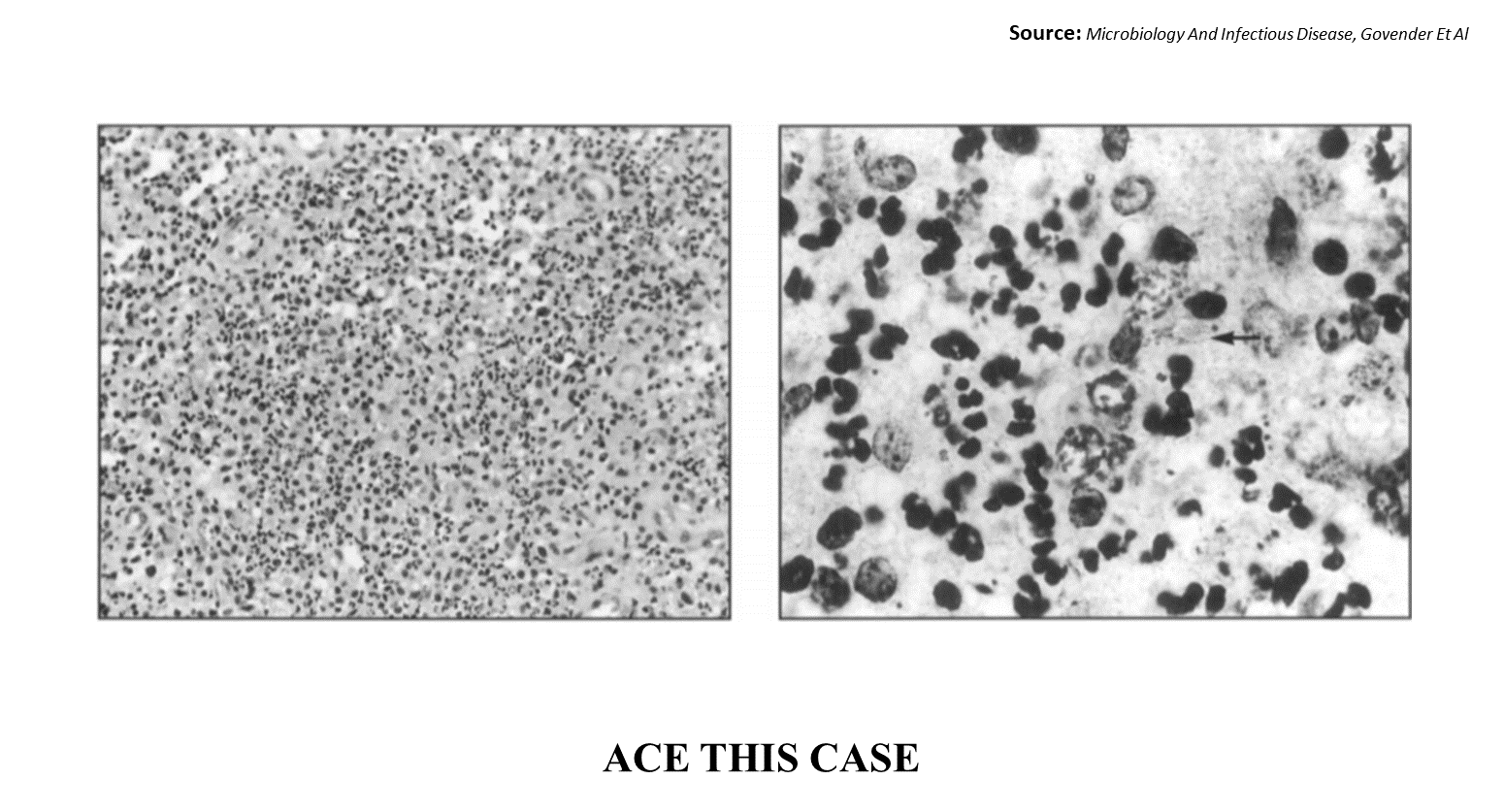 Can You Diagnose This Sexually Transmitted Disease?