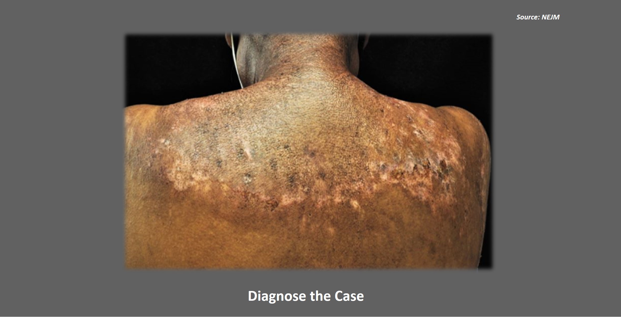 Identify the Reason for this Pruritic Rash