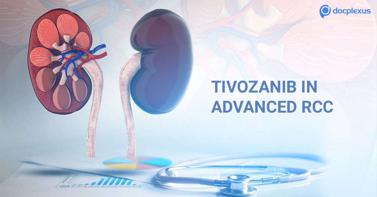 Tivozanib for Advanced Kidney Cancer in Adults
