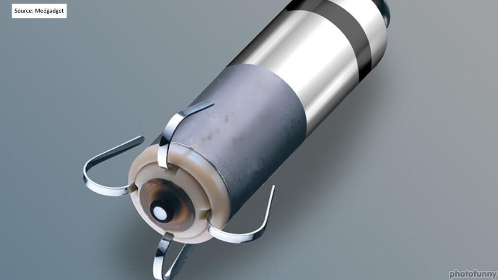 World’s Smallest Pacemakers Launched in India