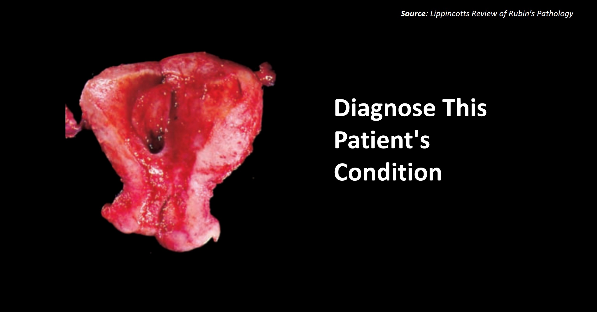 Can You Diagnose This Patient's Condition?