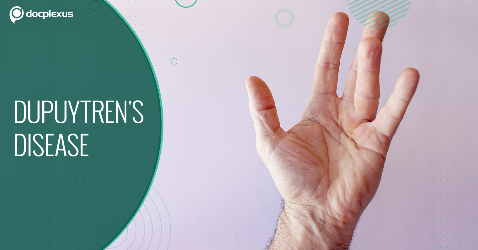 How Much Do You Know About Dupuytren's Disease?