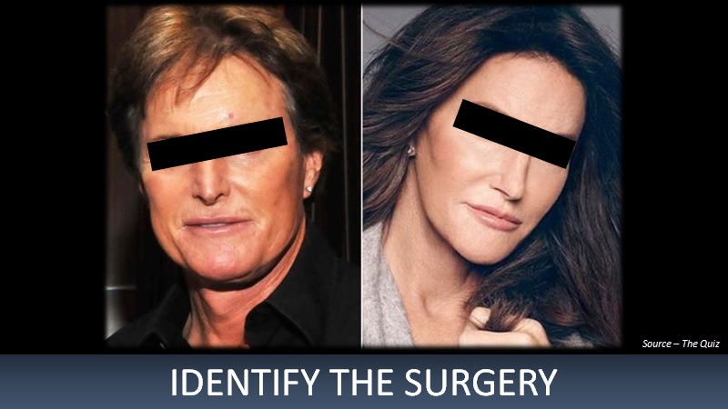 Identify The Surgery