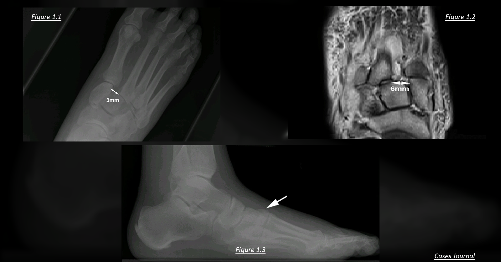 Solve This Case Based on Radiological Evidence