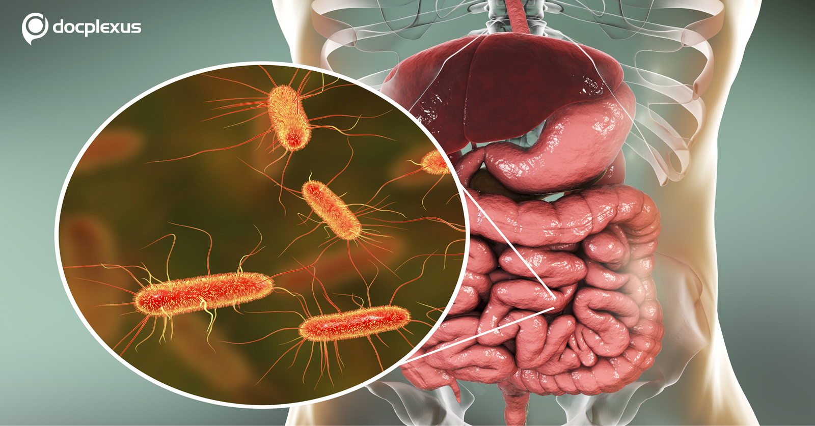 Impact of  B. infantis on Infants’ Immune Systems