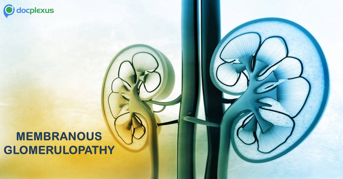 Membranous Glomerulopathy – Back to Basics