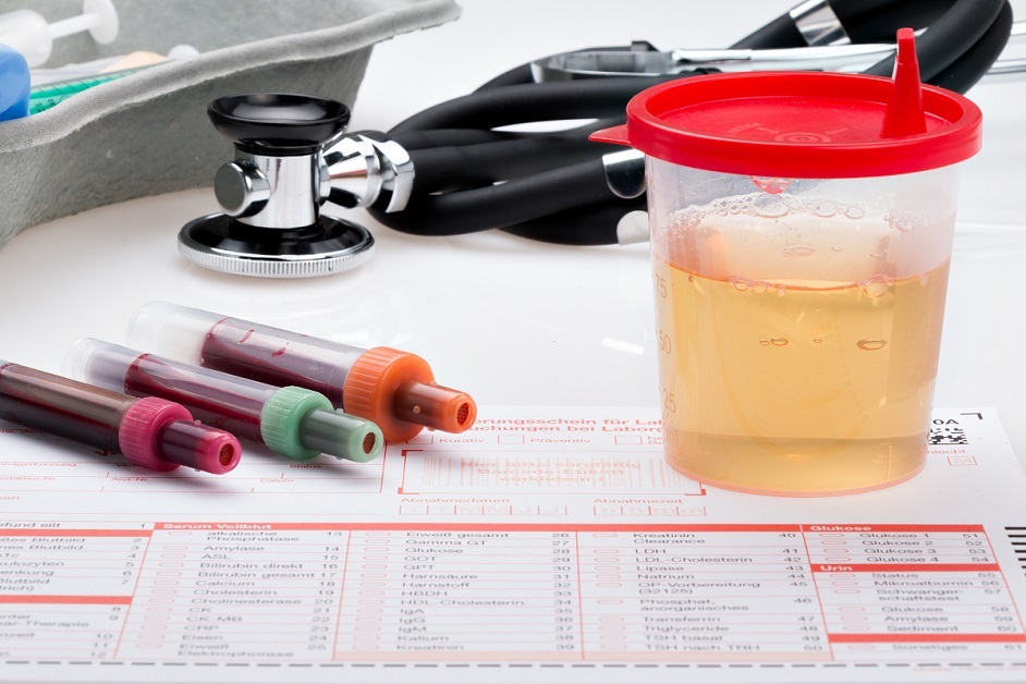 Case of a Man with Multiple Episodes of Blood in Urine