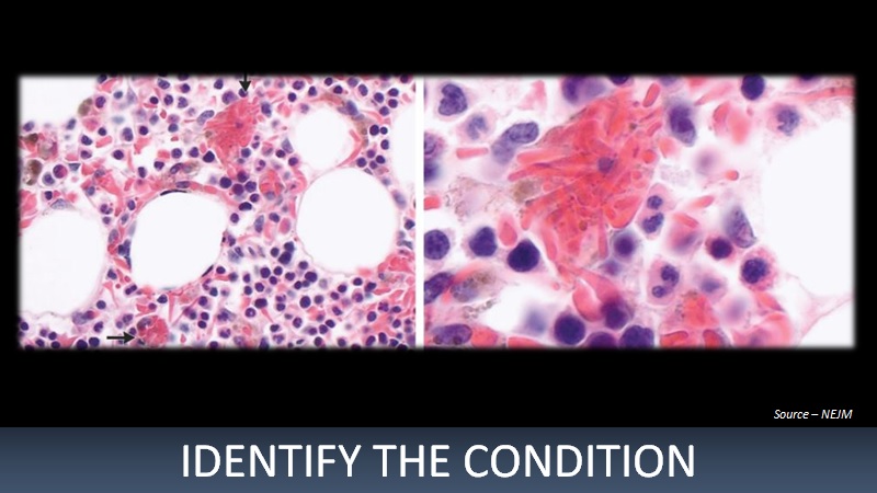 Infer These Microscope Findings