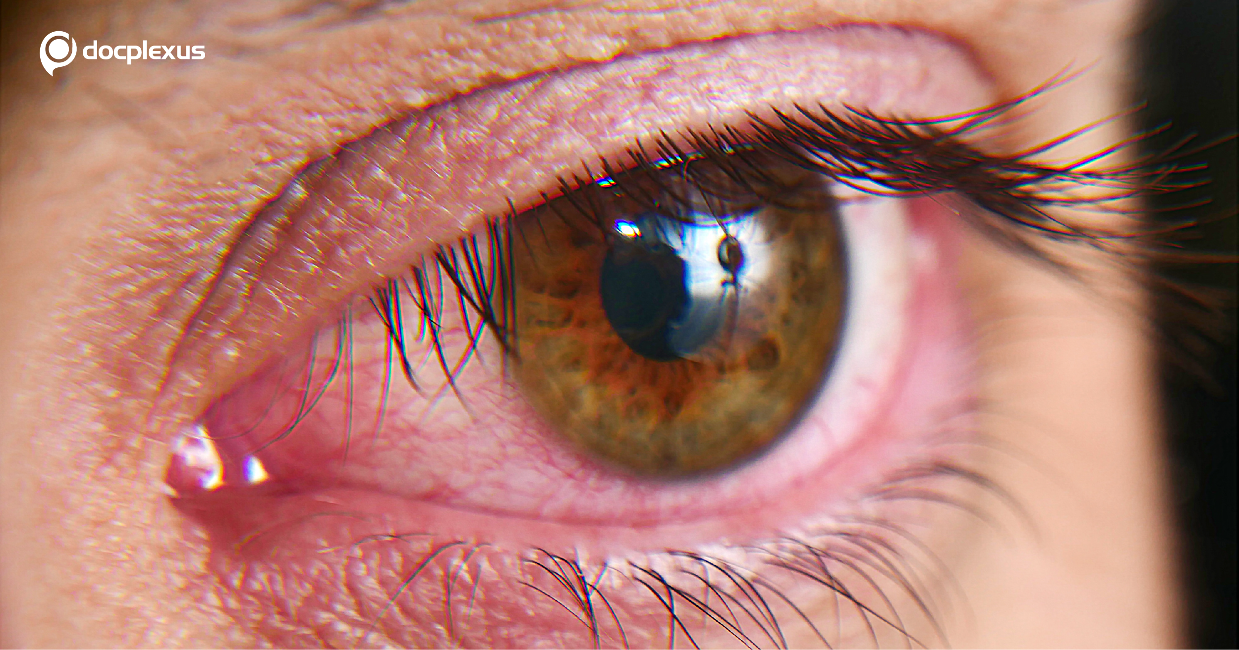 Study: Dry Eyes Highly Prevalent in Dubai