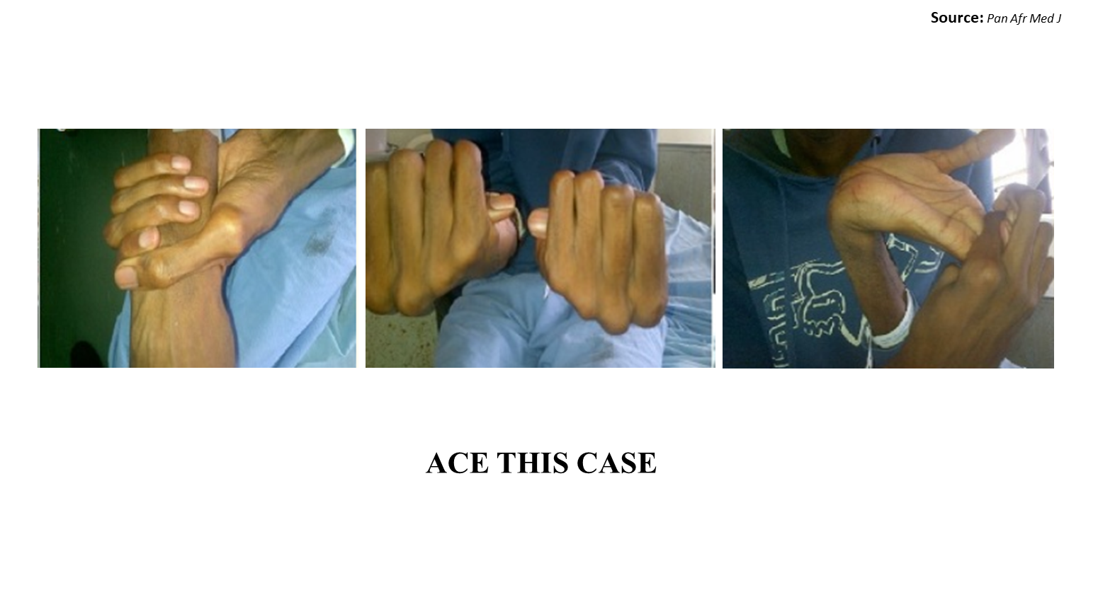 Diagnose this Genetic Disease