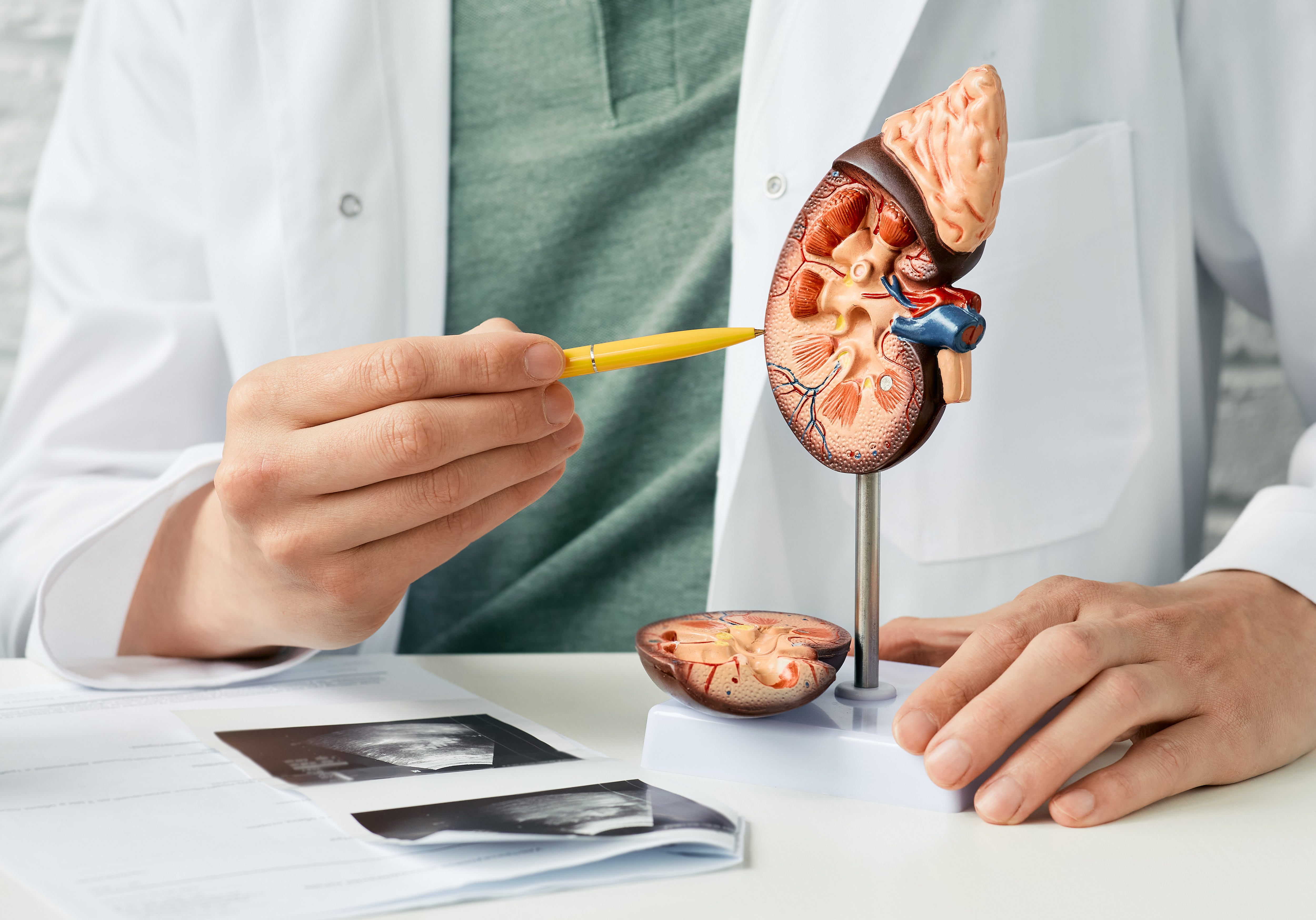 The Past and Future of Kidney Cancer Treatment