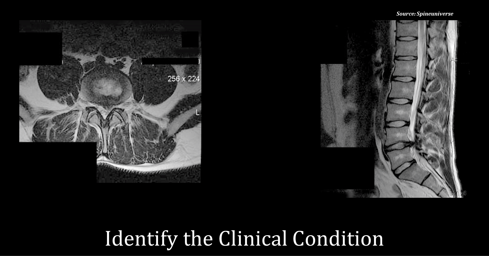 Ace This Case with the Help of the Radiological Evidence