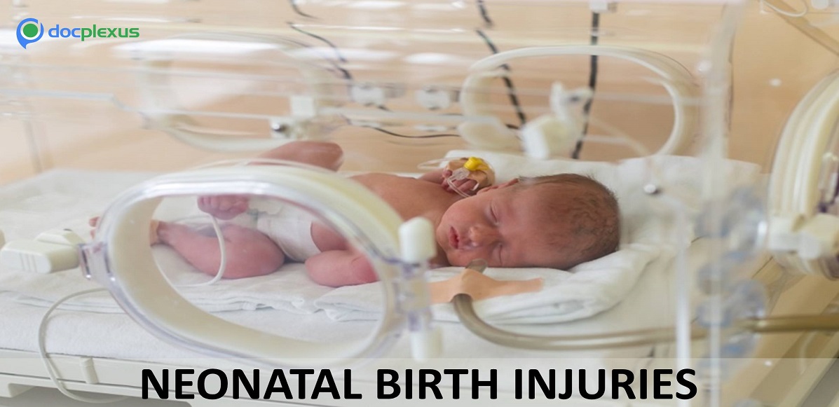 Ace This Quiz on Birth Injuries