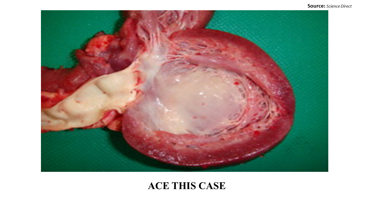 Case of an Infant with Acute Respiratory Distress