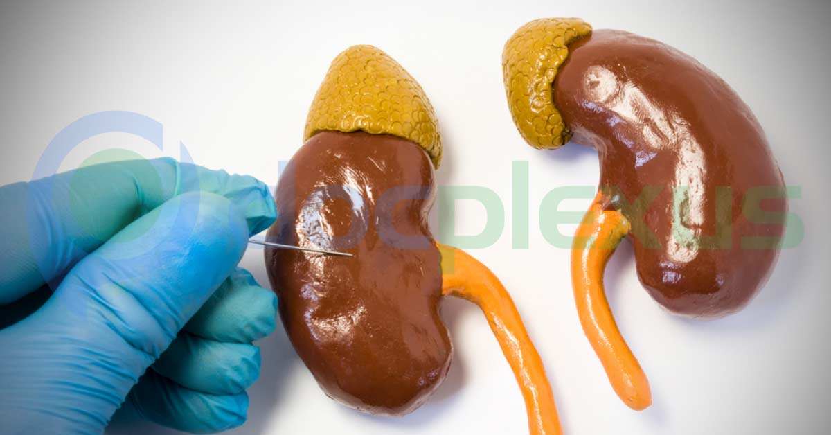 Urology Case Challenge