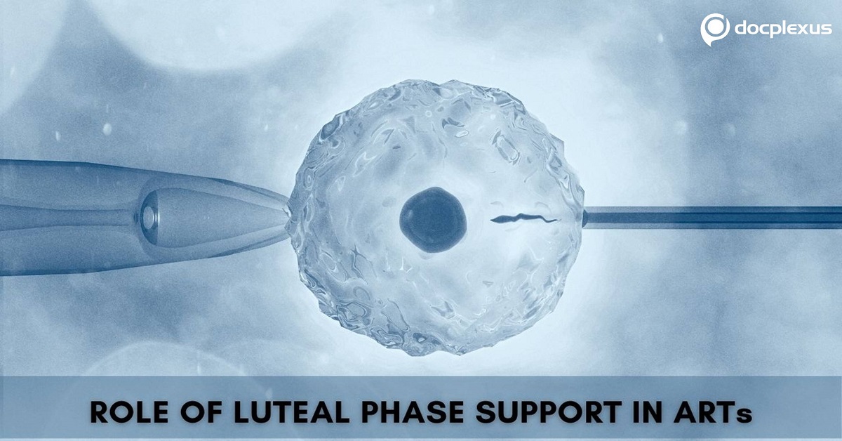 Importance of Luteal Phase Support in Assisted Reproductive Technology