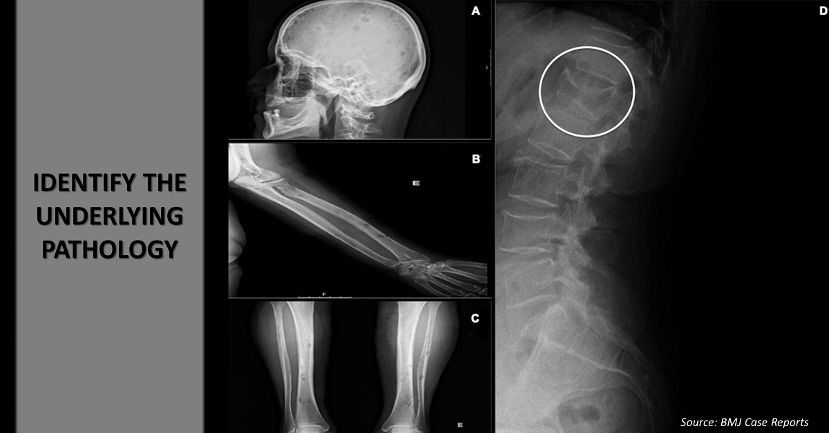 Can You Identify the Underlying Pathology?