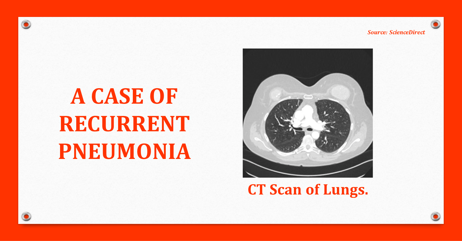 Can You Identify the Reason Behind Recurrent Pneumonia in This Woman?