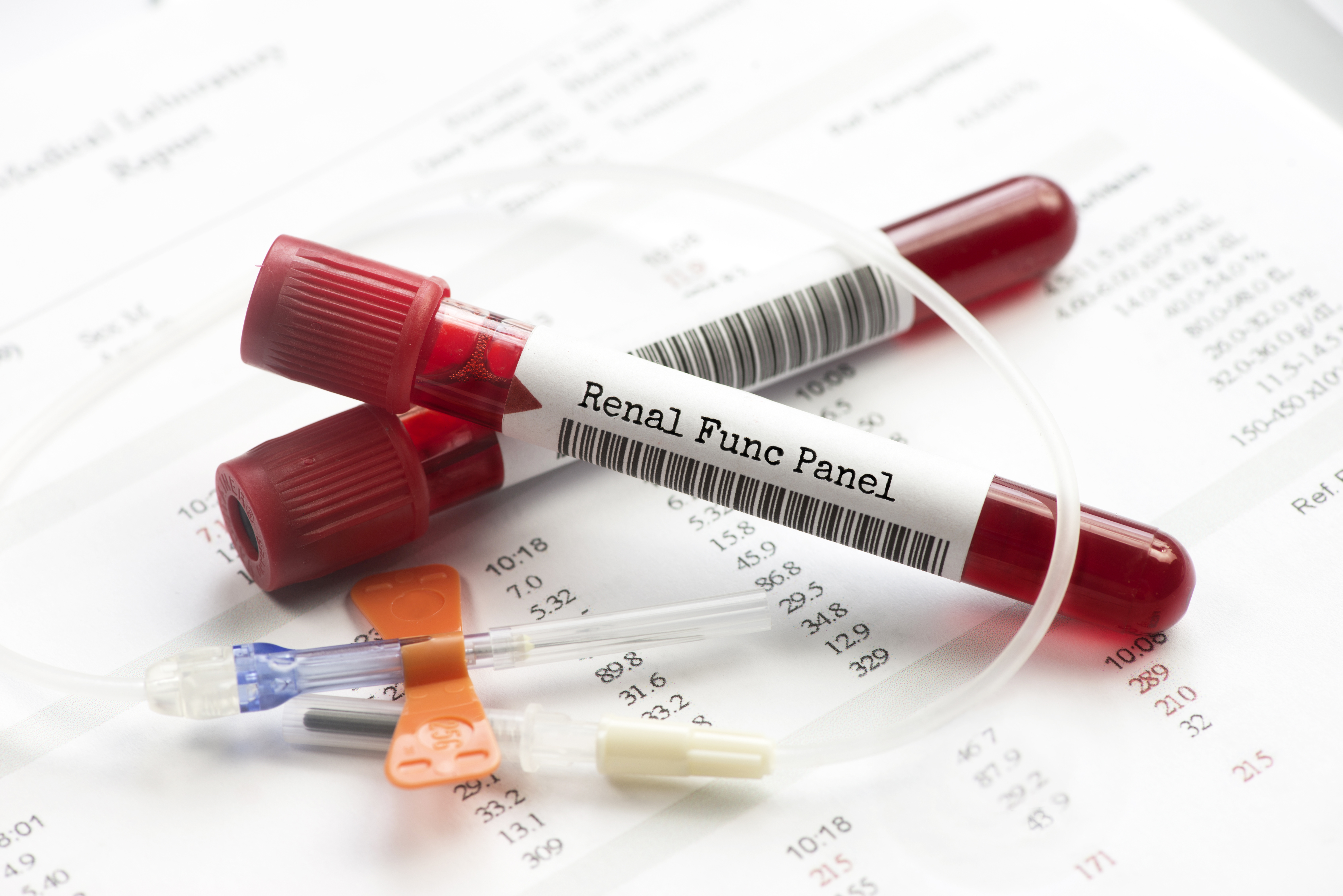 Test Your Knowledge of Renal Function Tests