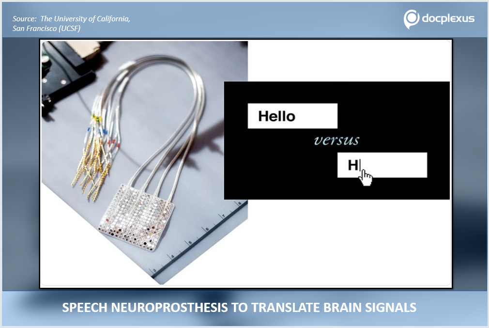 Speech Decoding Neuroprosthesis Enables Translation of Brain Signals to Speech