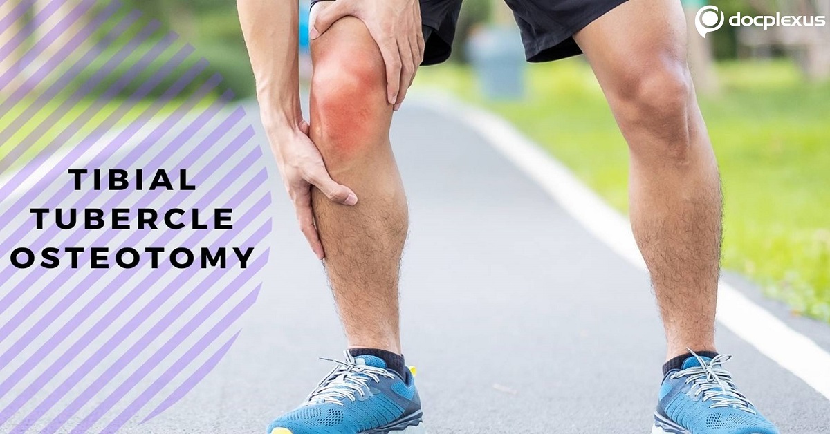 Tibial Tubercle Osteotomy: Surgical Correction of Recurrent Patellofemoral Instability