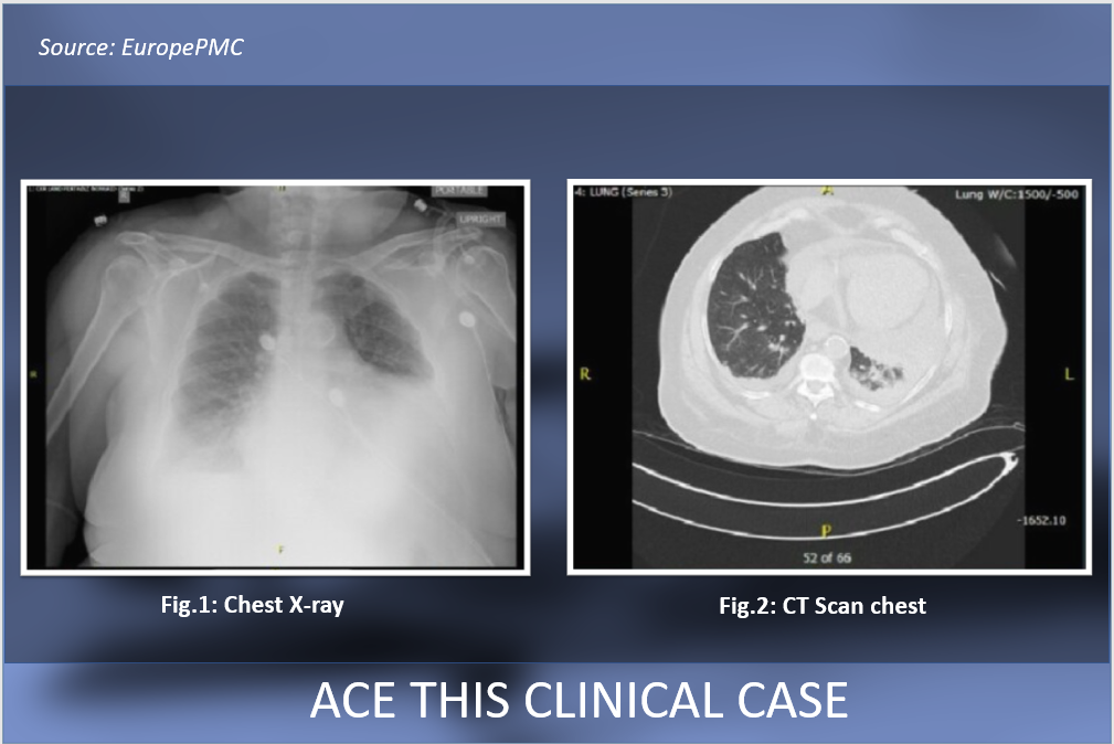 Manage this Case of Shortness of Breath