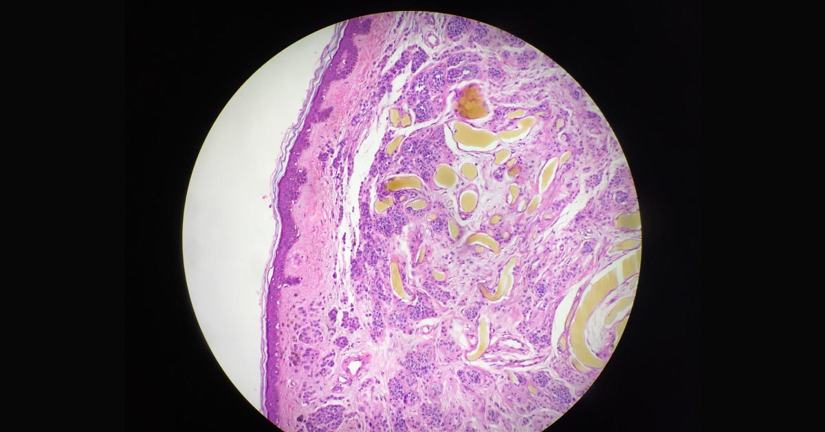 Can You Identify This Disorder?