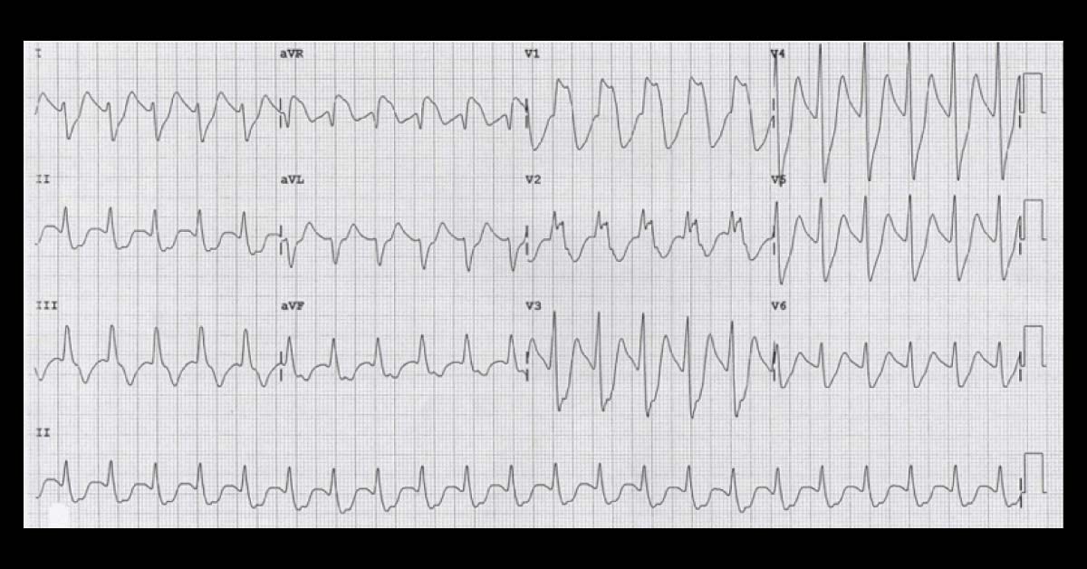 Can You Diagnose This Case of Seizure?