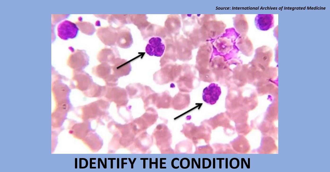 Identify the Cause of Maculopapular Lesions on the Skin