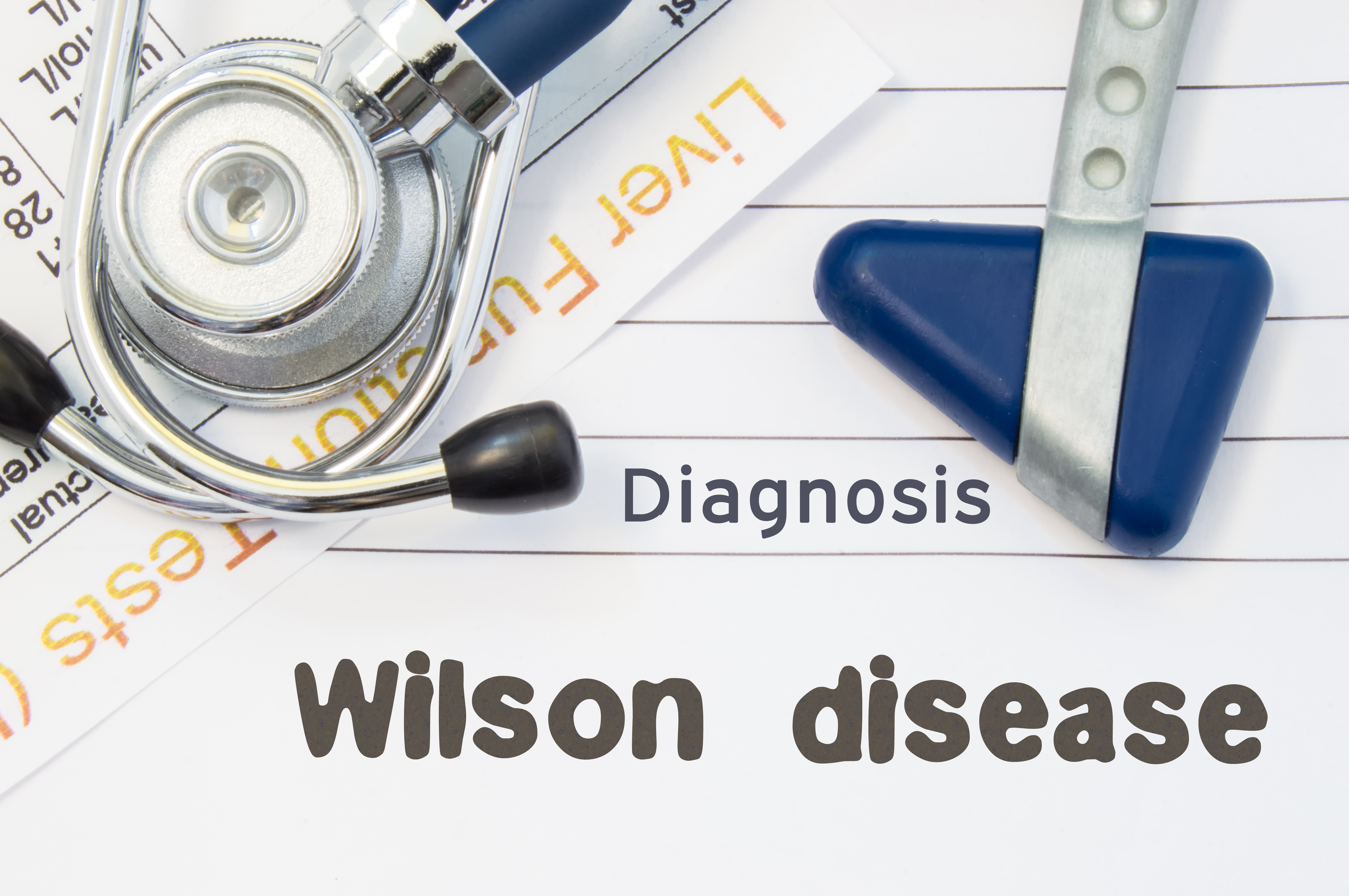 Wilson's Disease: A Congenital Eye Illness