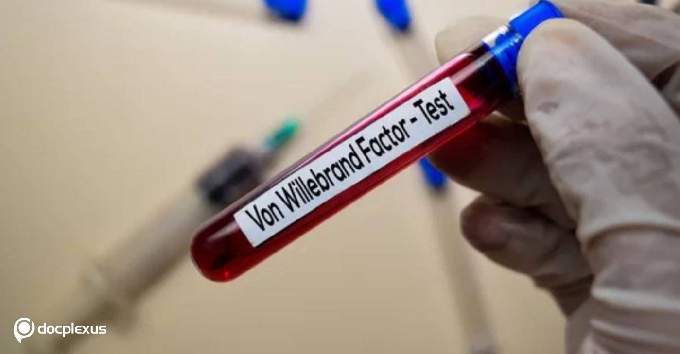 Identify the CORRECT statement on Von Willebrand Factor
