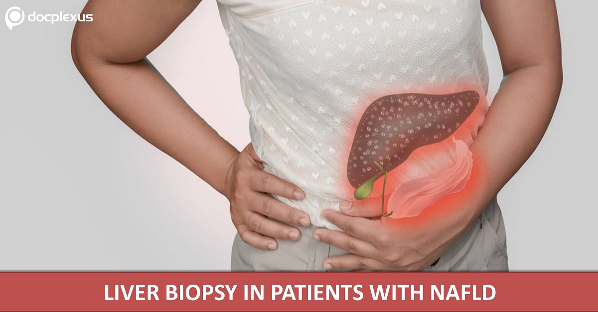 Liver Biopsy in NAFLD Patients