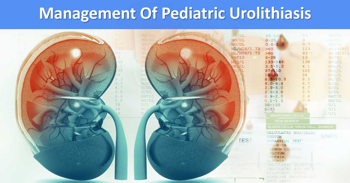Managing Pediatric Urolithiasis