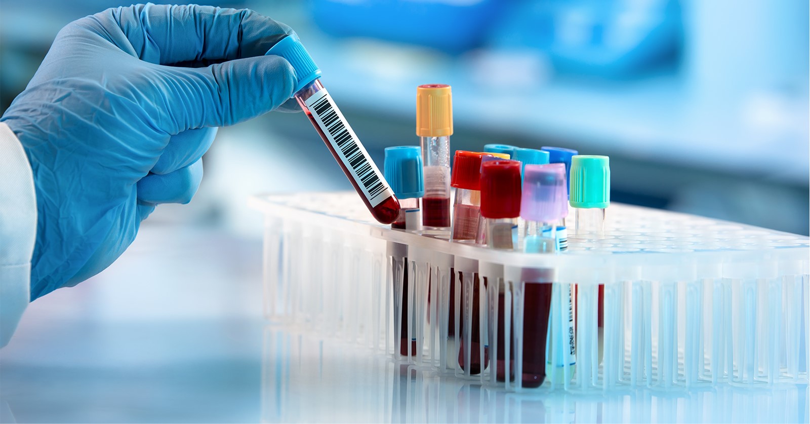 Diagnostic Test to Determine the Risk Status of COVID-19 Patients