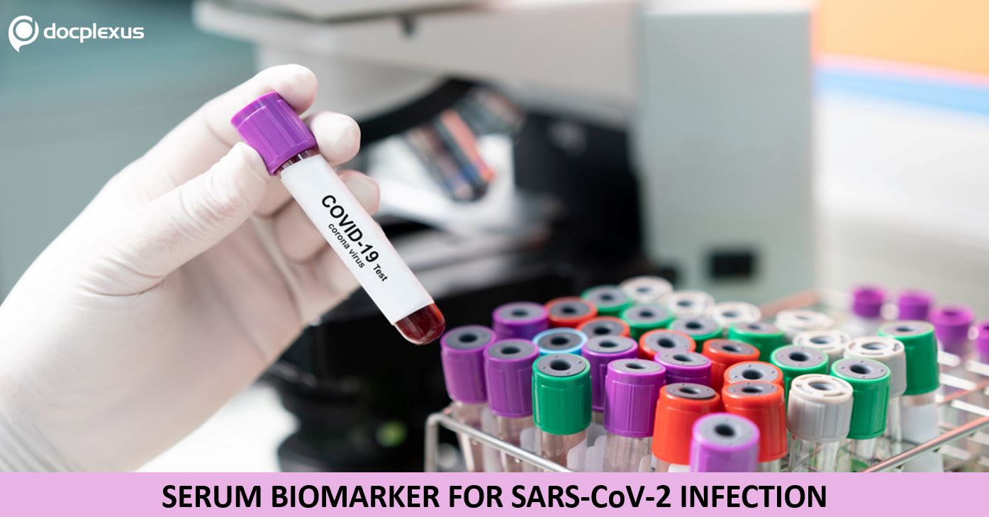 ddhC: A Potential  Serum Biomarker for SARS-CoV-2 Infection