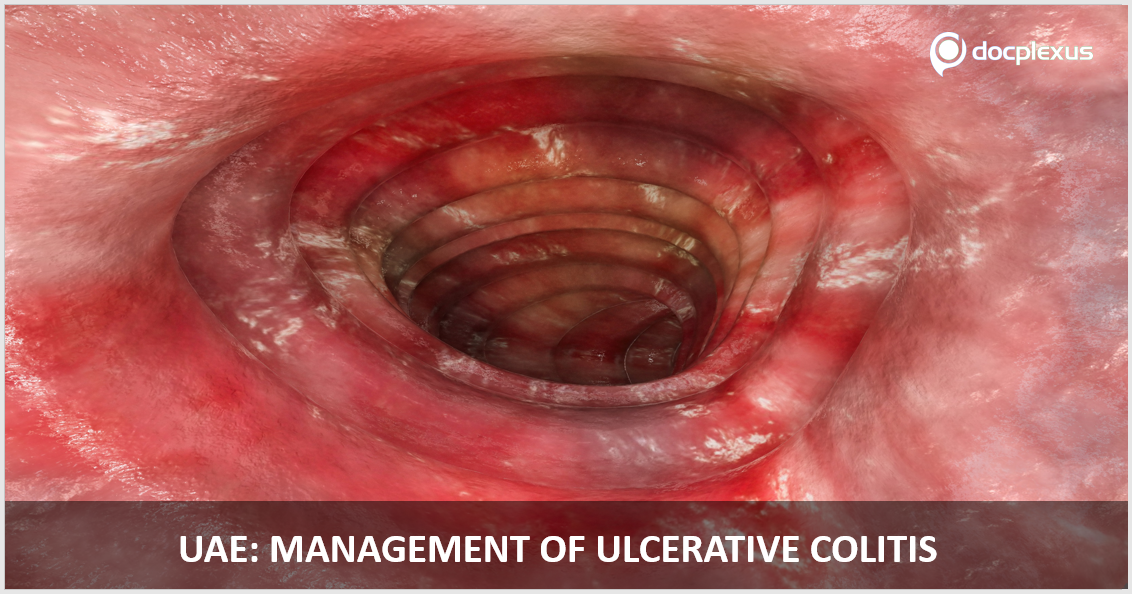 UAE Guidelines on the Management of Ulcerative Colitis