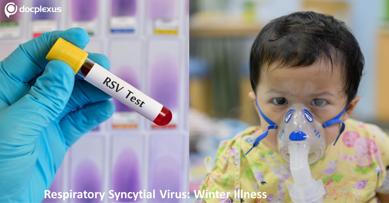 Respiratory Syncytial Virus: A New Challenge