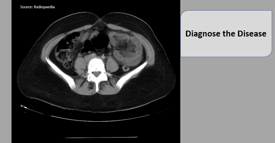 Pelvic Pain Post C-section- What’s Your Diagnosis?