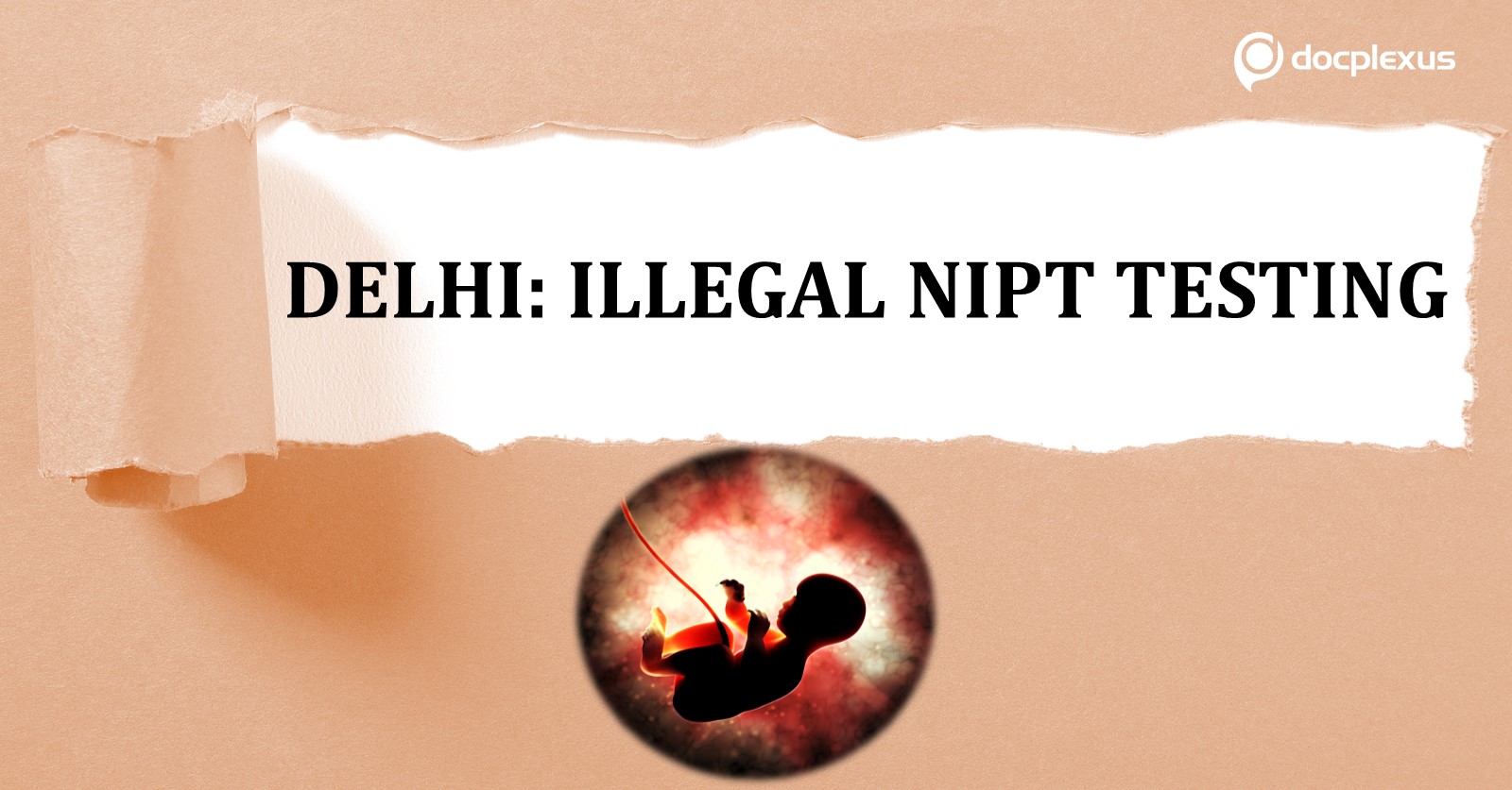 Unauthorized NIPT Testing in 3 Labs from Delhi