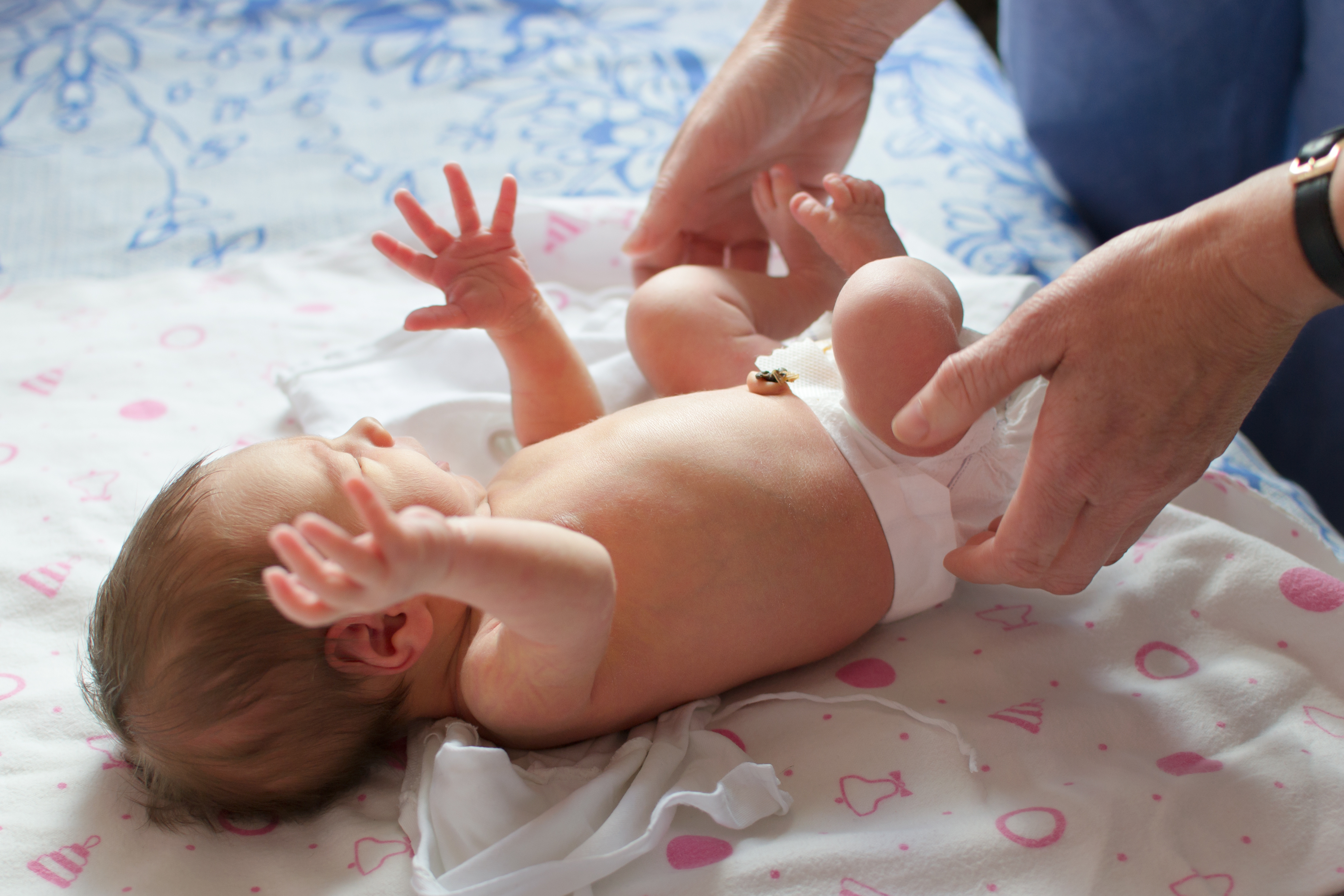 What Would be the Appropriate Management Strategy for This Neonate