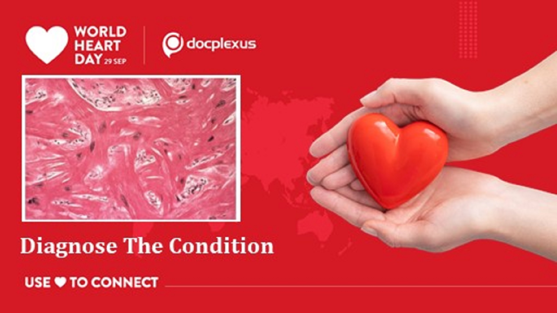 A Teenager with Ventricular Tachycardia