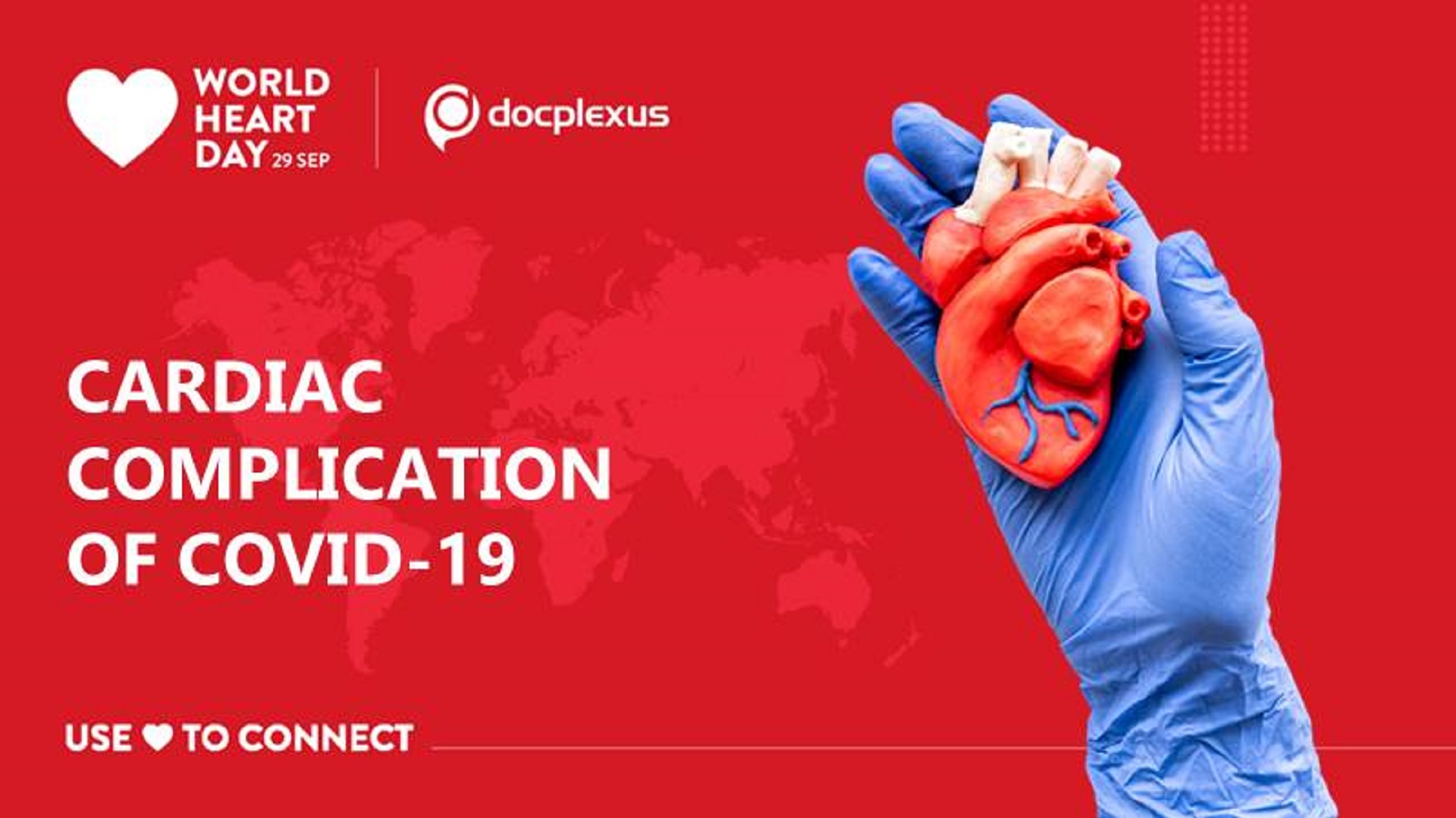 A Cardiac Complication of COVID-19