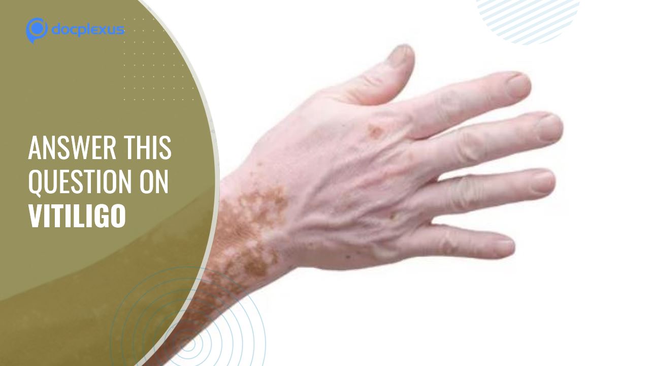 Phototherapy in Vitiligo