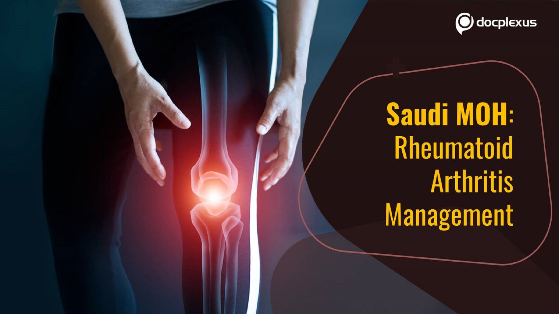 Saudi MOH Guidelines for the Management of Rheumatoid Arthritis in Adults