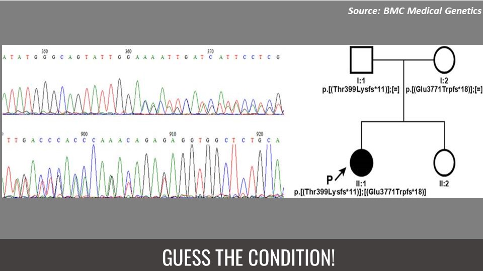 A Child with Photophobia and Macular Degeneration, Diagnose the Condition!