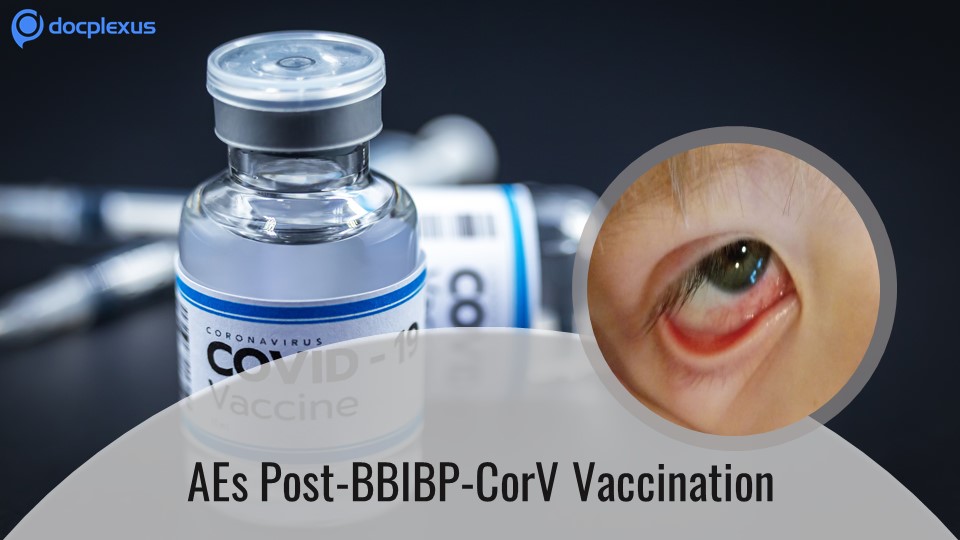 Ocular Adverse Events of COVID-19 Vaccine